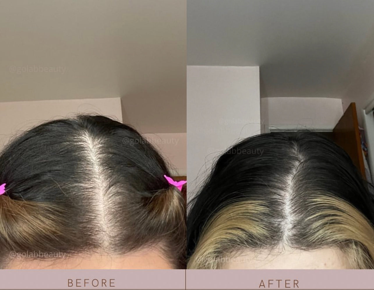 Strengthening Scalp Massage Oil