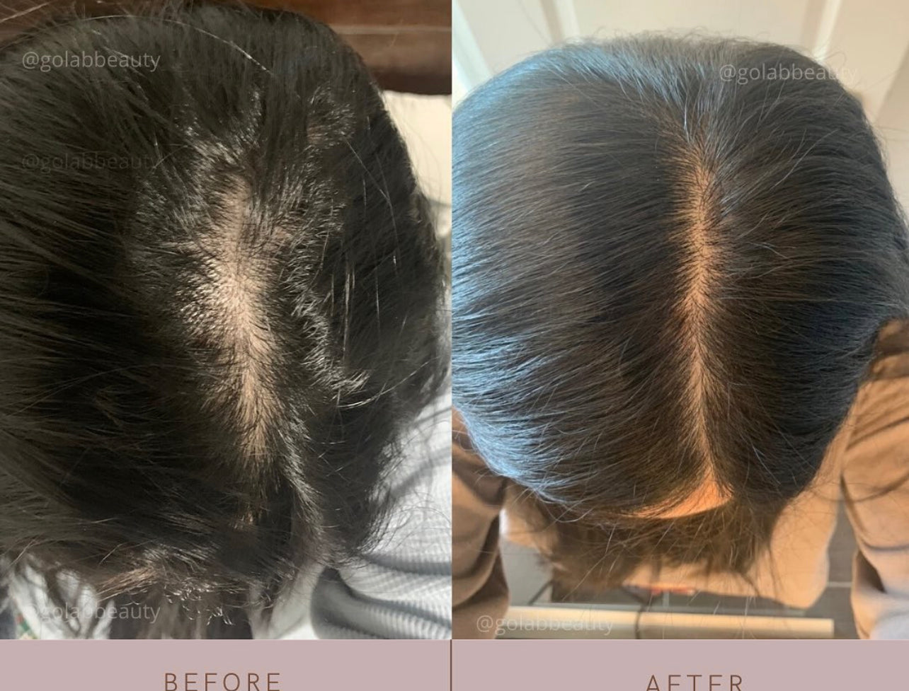 Strengthening Scalp Massage Oil