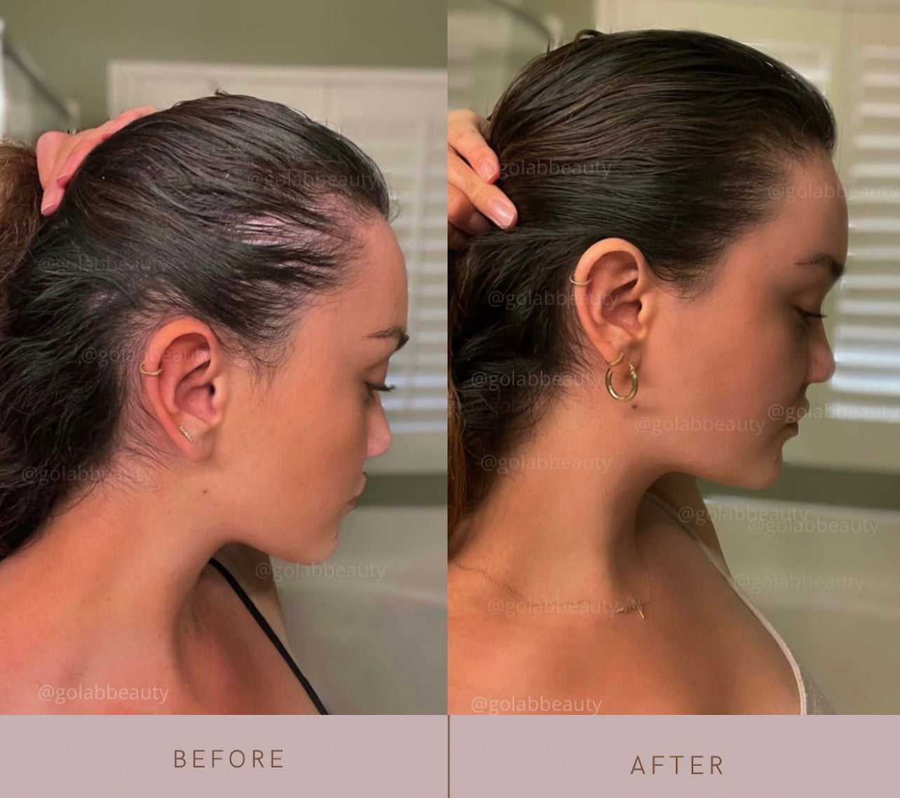 Artistic Golab Beauty Scalp Oil Design for Mobile Artistic Golab Beauty Scalp Oil Design for Mobile