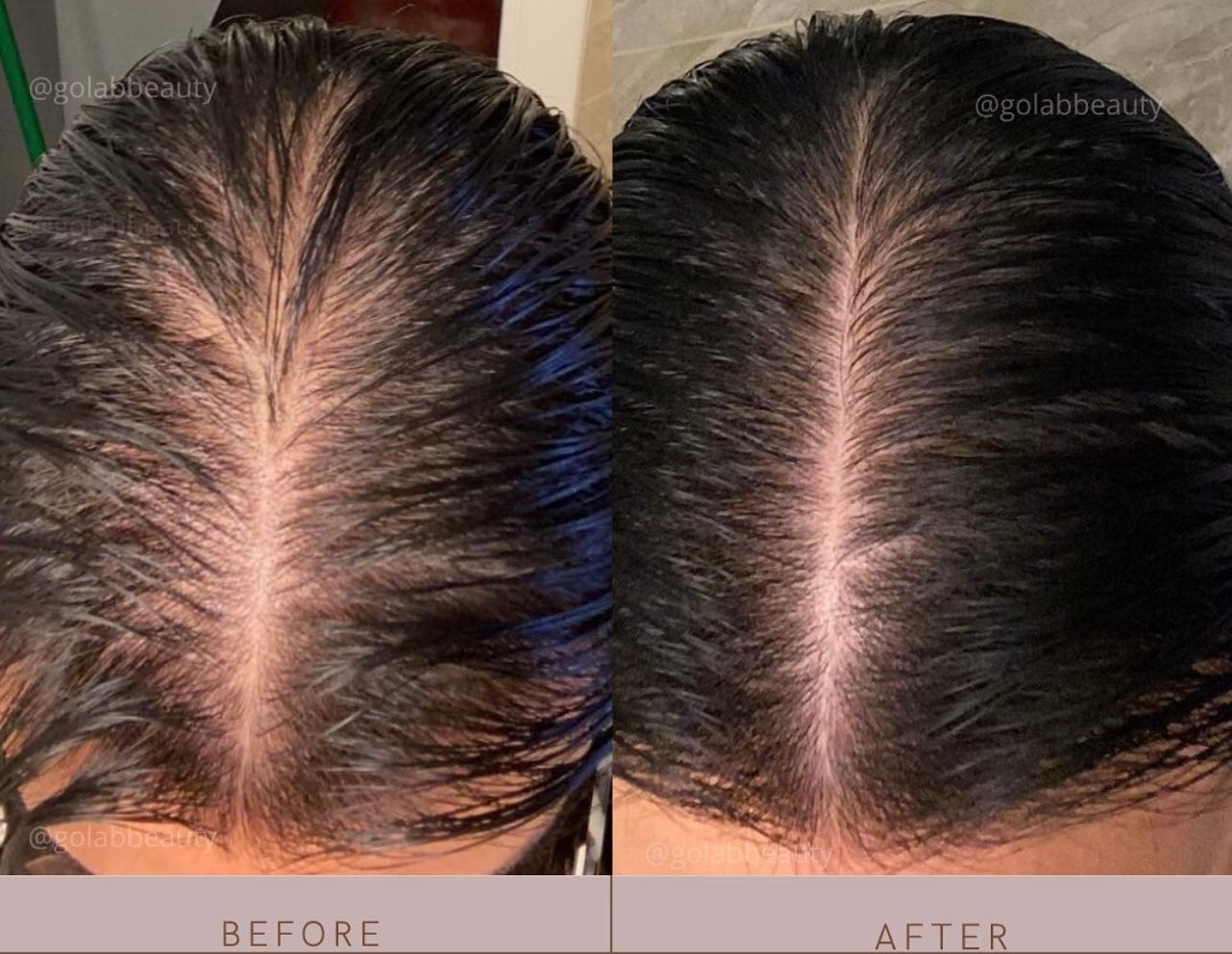 Strengthening Scalp Massage Oil